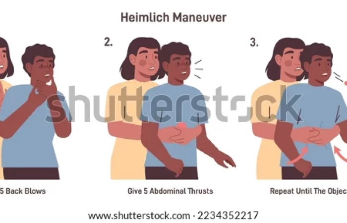 choking-first-aid-adult-heimlich-600w-2234352217